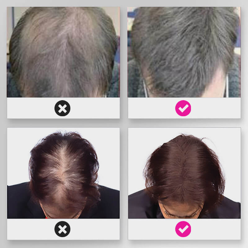 Hair Thickening Hair Building Fiber Powder