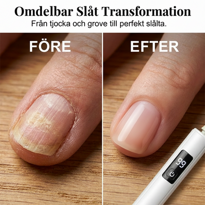 ✨ Professionell elektrisk nagelfil med 99 hastighetsnivåer och 4 sliphuvuden – för exakt nagelvård hemma 💅